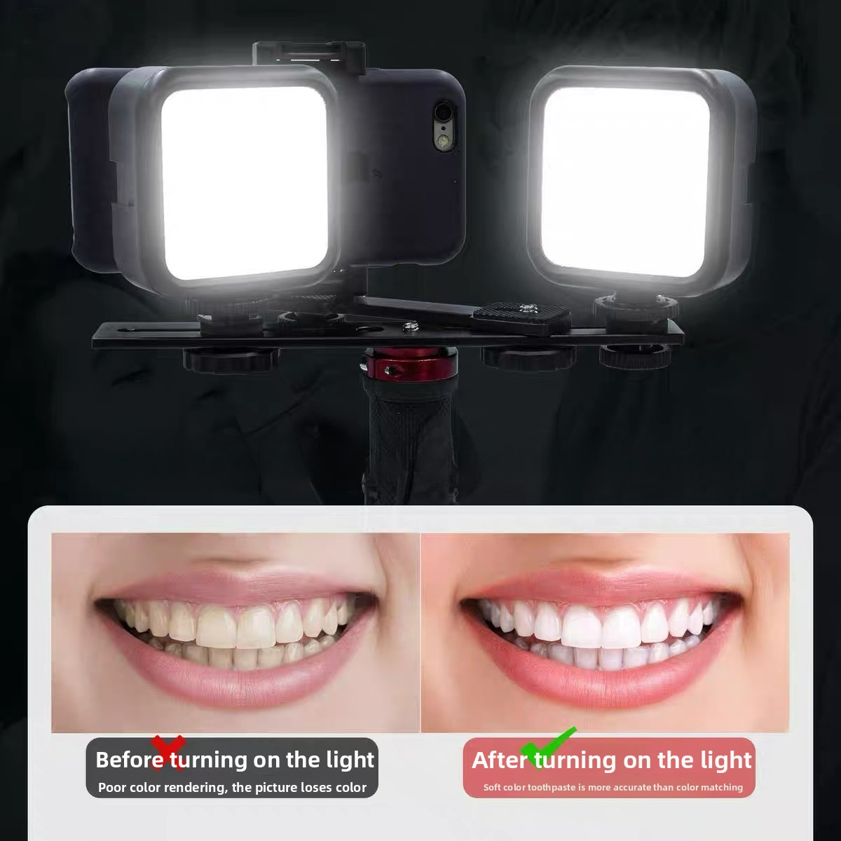 Photography Mobile Lighting - Dental Photography Light with Bluetooth Oral